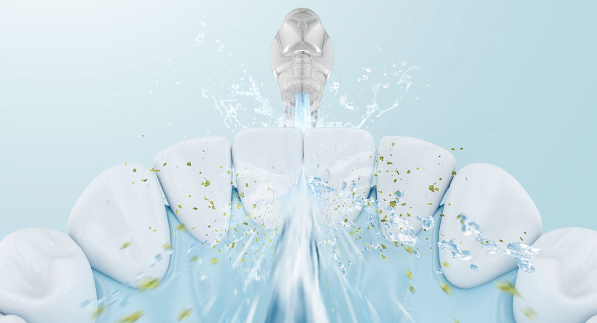 Tia nước mạnh với công nghệ siêu âm giúp loại bỏ các mảnh vụn thức ăn giữa các kẽ răng.